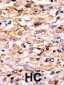 GCN2 Antibody (N-term G11)